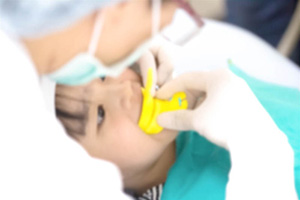 Fluoride-Treatment (1)