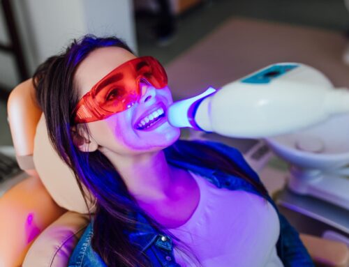 Professional vs. DIY Teeth Whitening: Which to Choose?